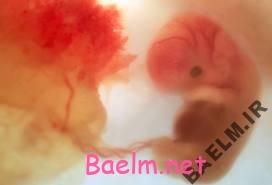 تشخيص اوتيسم از روي جفت نوزاد