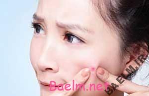 قطره استریل چشمی درمانی برای جوش