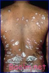 دارونامه | موارد مصرف و عوارض داروی دیترانول