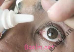 دارونامه | موارد مصرف و عوارض داروی کارباکول ( چشمی)