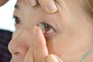  لنز, لنز رنگی, لنز طبی