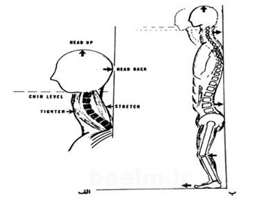 ورزش درمانی,حرکات اصلاحی برای ناهنجاری سر به جلو,تمرینات ورزشی