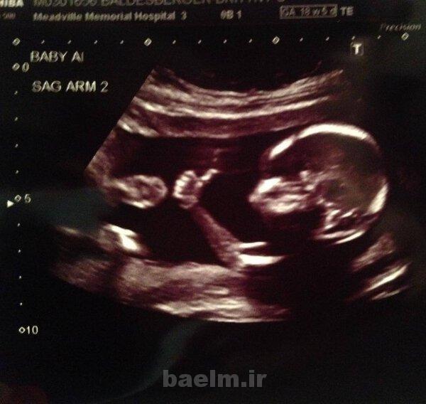 ديدنيها | عكس هاي جالب ، ديدني و خنده دار روزانه | 8 شهريور ديدنيها | عكس هاي جالب ، ديدني و خنده دار روزانه | 8 شهريور