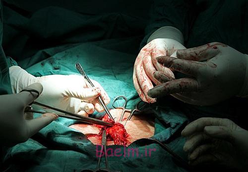 (تصاویر) درآوردن تومور 10کیلویی از شکم (تصاویر) درآوردن تومور 10کیلویی از شکم