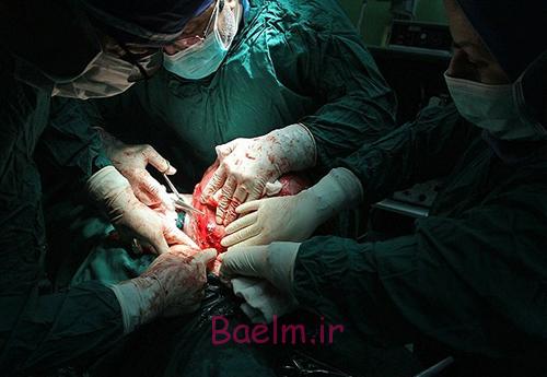 (تصاویر) درآوردن تومور 10کیلویی از شکم (تصاویر) درآوردن تومور 10کیلویی از شکم