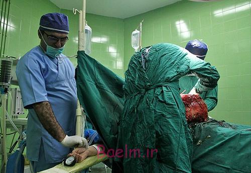 (تصاویر) درآوردن تومور 10کیلویی از شکم (تصاویر) درآوردن تومور 10کیلویی از شکم