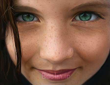 ارثی بودن کک و مک ،درمان کک و مک درمان کک و مک