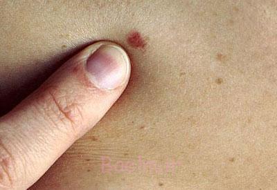 چگونگی معاینه بدن معاینه سینه,پیشگیری از بیماریها,نحوه معاینه بدن