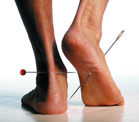 احساس کرختی و بی حسی در پاها پاها,نشانه های بیماری, علت بی حسی در پاها