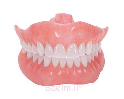 پروتز متحرک دندان,پروتز دندان,پروتز کامل دندان