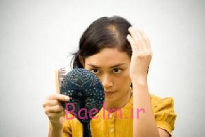 جلوگیری از "ریزش مو " | روش های خانگی و طبیعی جلوگیری از کم مویی جلوگیری از "ریزش مو " | روش های خانگی و طبیعی جلوگیری از کم مویی